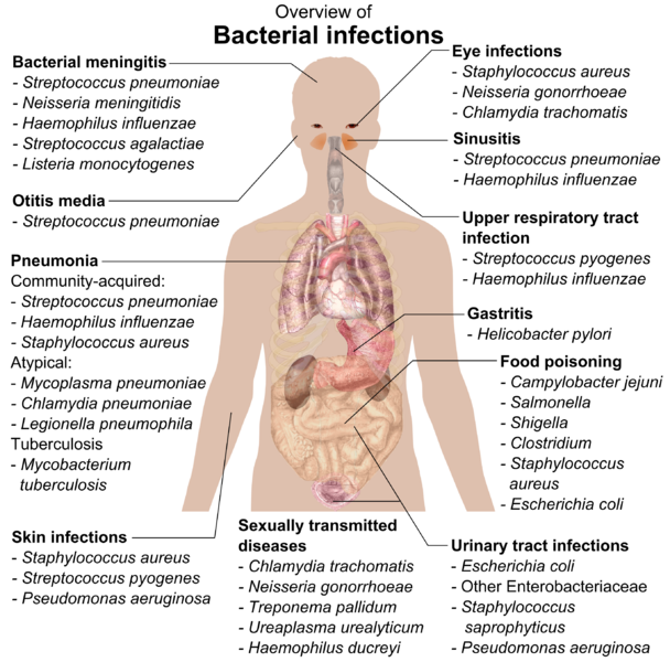 File:Bacterial infections and involved species.png